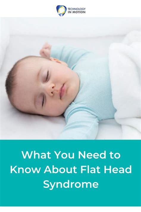 What You Need To Know About Flat Head Syndrome Flat Head Syndrome