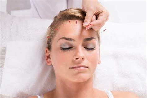 Everything You Need To Know About Acupuncture And Its Benefits Recentlyheard Breaking News
