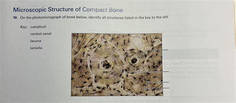 On the photomicrograph of bone below, identify all structures listed in