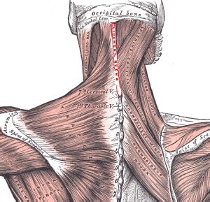 Whiplash associated disorders and neck rehabilitation. Ligamentum nuchae - Physiopedia