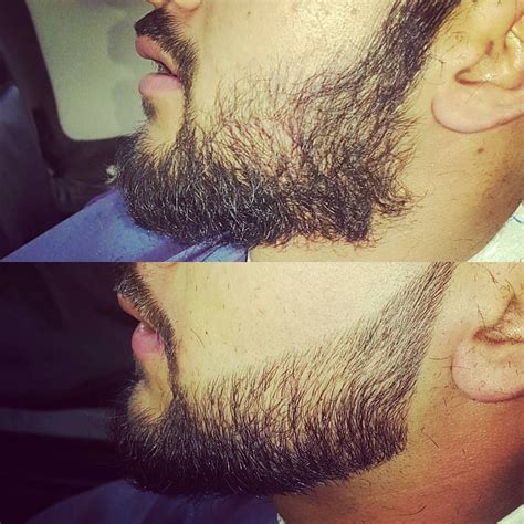 Beard Correction Trimnificent Before And After Look 😇😇 Elegance
