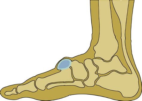 Ganglion cysts are a common condition that can develop on the top or bottom of the foot.they are not harmful or cancerous, although they may cause discomfort. What about ganglion cysts on the foot? | Ganglion Cysts ...