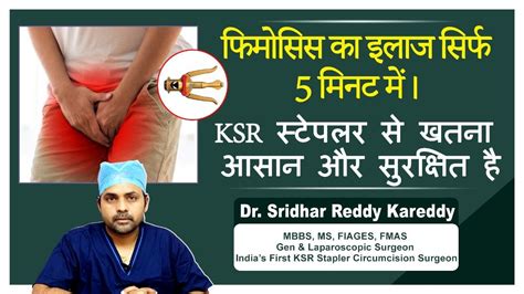 Best Treatment For Phimosis Ksr Stapler Circumcision In India Tight Foreskin Circum Cure