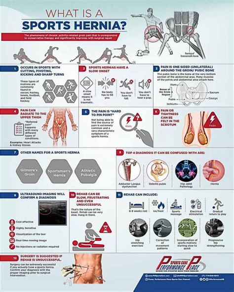 12 Truths About Sports Hernias Your Doctor Didnt Tell You