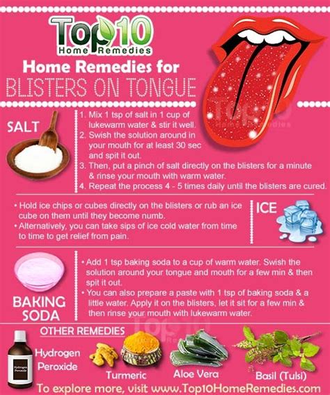 Home Remedies For Blisters On Tongue Top 10 Home Remedies