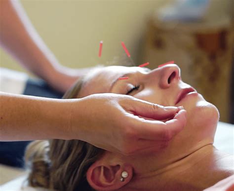 Cosmetic Acupuncture - Therapy Lounge