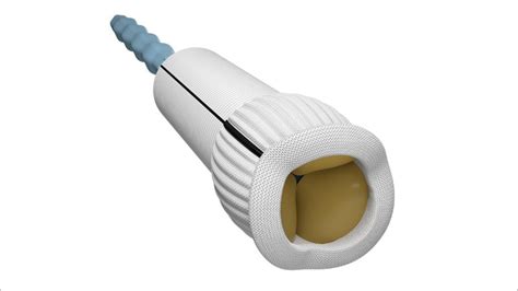 Fda Clears Edwards Konect Resilia Aortic Valved Conduit