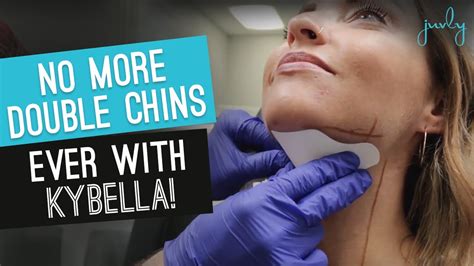 An Effective Double Chin Removal Try The Visible Results By The