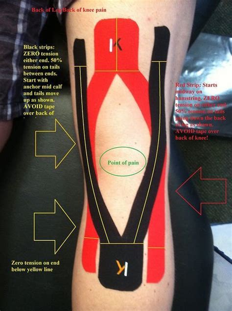 Image Result For Taping Biceps Femoris Tendon Kt Tape Knee Knee Taping