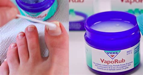 10 Top Unconventional Vicks Vaporub Uses You Must Know