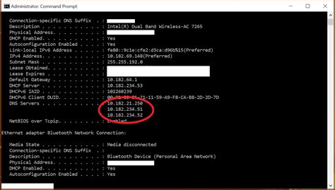 How To Find Dns Server Address