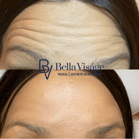 Products Offered By Bella Visage Lakeland