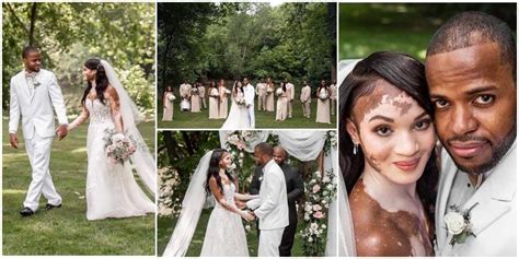 Massive Reactions As Man Ties The Knot To Lady With Vitiligo He Shares Wedding Photos Briefly