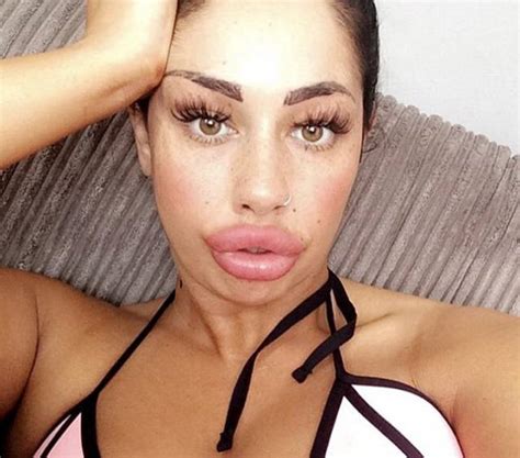 This Woman Wants To Take Her Huge Lips And Make Them Even Bigger 11 Pics
