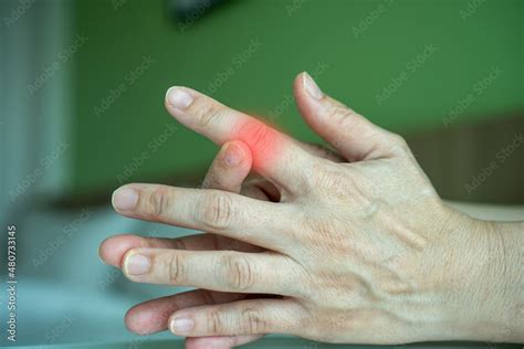 Fotografia Do Stock Trigger Finger Overuse Hand Problems Womans Hand