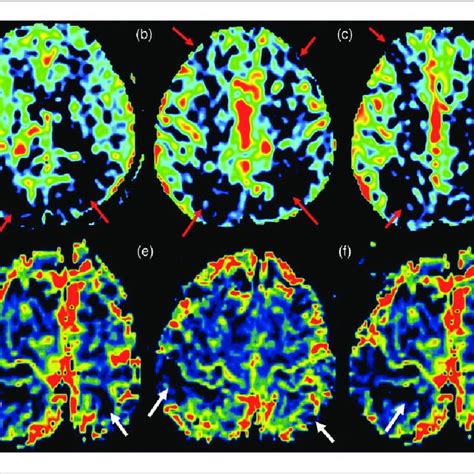 Follow Up Brain Magnetic Resonance Imaging With Conventional Imaging Download Scientific