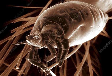 Head Louse Sem Stock Image C0038881 Science Photo Library