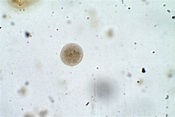 Entamoeba coli – Cyst – Parasitology