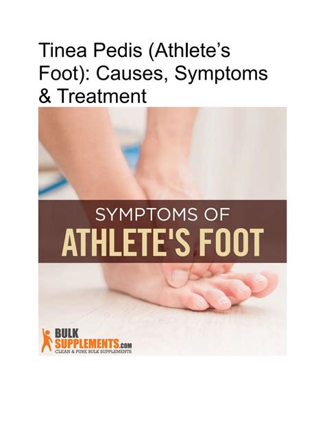 Tinea Pedis Athletes Foot Causes Symptoms Treatment By