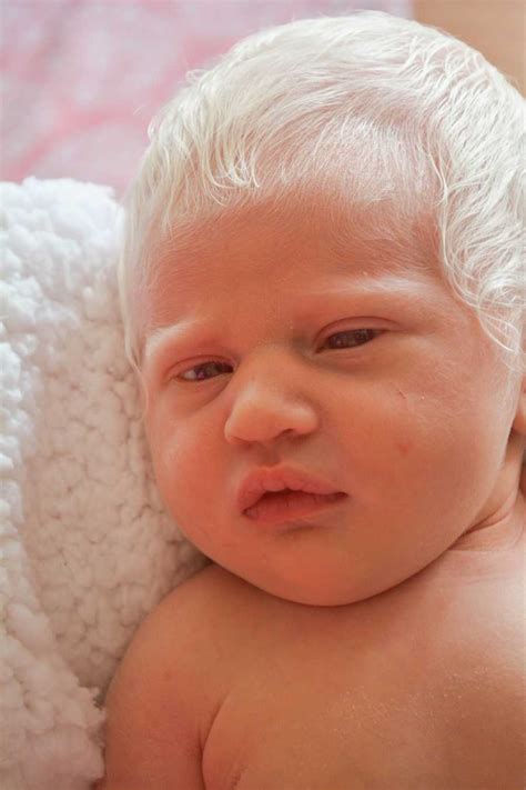 Baby Babe Born With Snow White Hair Dubbed Prince Charming Content Mix