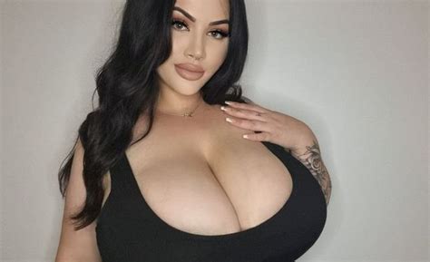 Woman S Rare Condition Causes Breasts To Grow Four Bra Cup Sizes In One Year Causing Crippling