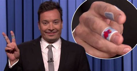 Jimmy Fallon Explains Jagermeister Injury After Cutting Hand On Bottle