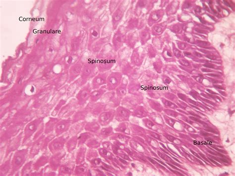 Stratified Squamous Epithelium Lm Photograph By Rober