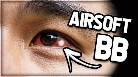 Kid Gets Airsoft Bb To The Eye Gets Stuck Youtube