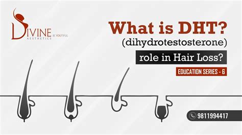 session 6 what is dht dihydrotestosterone and what does it do role of dht in hair loss