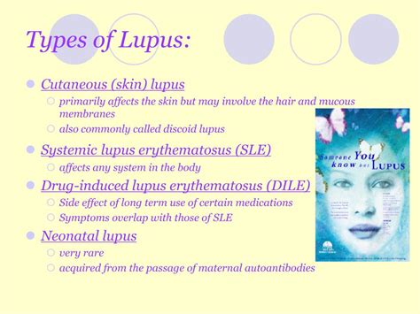 Ppt Lupus Erythematosus Powerpoint Presentation Free Download Id