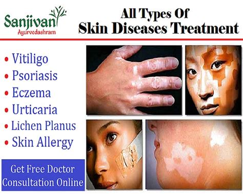 Skin Diseases Ayurvedic Treatment In India ~ Sanjivani Ayurvedashram
