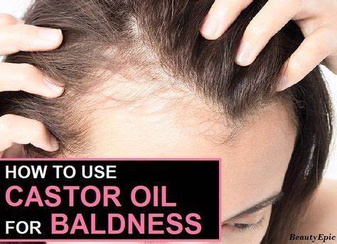Does Castor Oil Help Treat Baldness?
