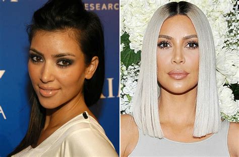Kim Kardashian Plastic Surgery True Or False Past Vs Present Photos