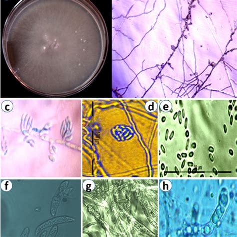 Morphological Characters Of Fusarium Falciforme A Colony Characters