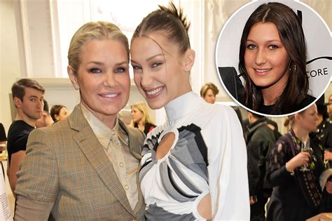 yolanda hadid slammed for letting bella get nose job at 14