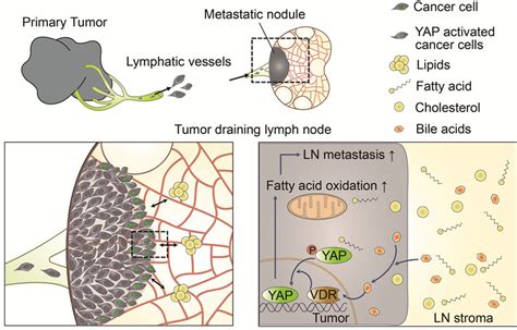 How Do Metastatic Tumor Cells Grow In Lymph Node