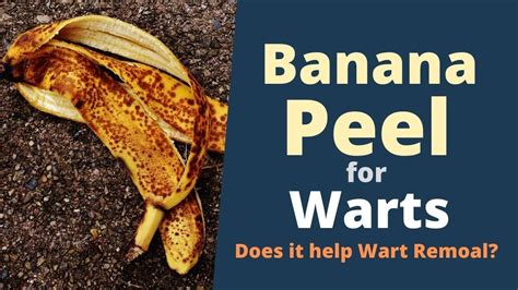 Banana Peel For Warts How To Use Banana Peel To Remove Warts Youtube