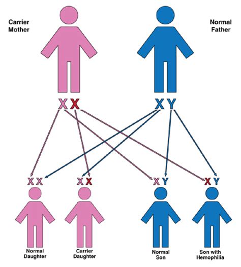 Children who do not have the trait will generally not pass the disease on to their children. How Hemophilia is Inherited > Genetics > HoG Handbook ...
