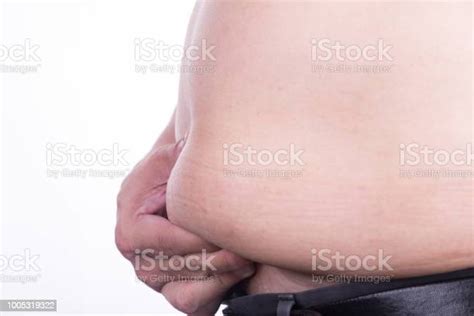 Closeup Of Man Holding Unhealthy Big Belly Visceral Subcutaneous Fats