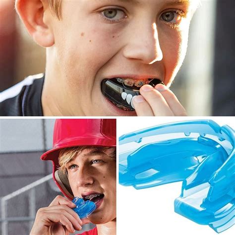 Smile Safe With Our 5 Five Picks Of Mouth Guards For Braces