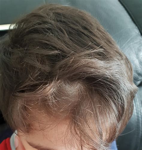 Toddler Haircuts For Cowlicks In Front - img-slobberknocker