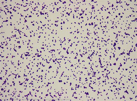 Staphylococcus Epidermidis 1000x 2 Flickr Photo Sharing