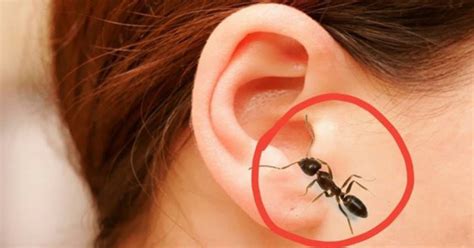 indian girl has ants crawling out of her ears every day the ugly minute