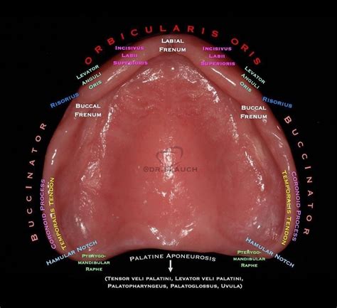 Surrounding Muscles Of Upper Complete Denture Escuela De Higiene