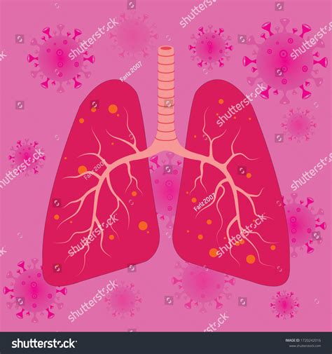 Viruses Bacteria Infect Human Lungs Lung Stock Vector Royalty Free