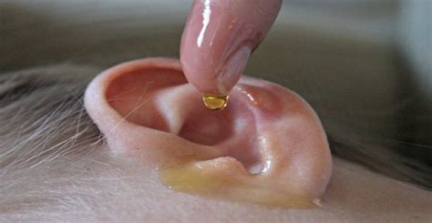 The treatment of swimmer's ear usually requires prescription medication. How to Prevent and Treat Swimmer's Ear | New Health Advisor