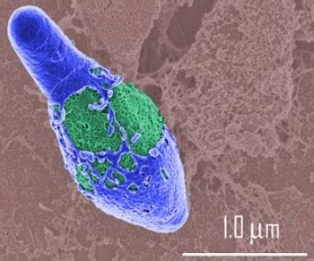 This genus includes several significant human pathogens, including the causative agents of botulism and tetanus. Clostridium botulinum | Körinfo