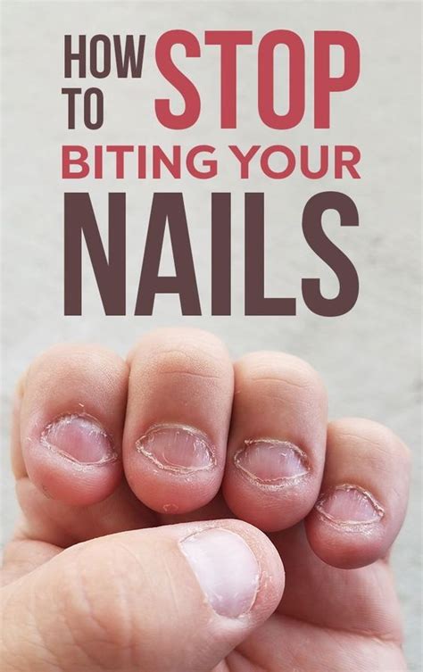 How To Stop Biting Your Nails Wellness Days