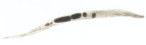 Twip 19 Enterobius Vermicularis The Pinworm This Week In Parasitism