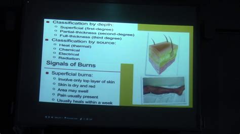 Chapter 26 Soft Tissue Injuries Burns And Musculoskeletal Intro Youtube